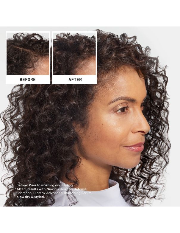 Nioxin Hair Fall Defense Shampoo - 240ml