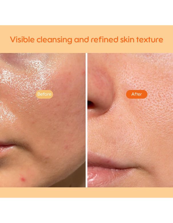Kiero Refining Enzyme Cleanser - 50g