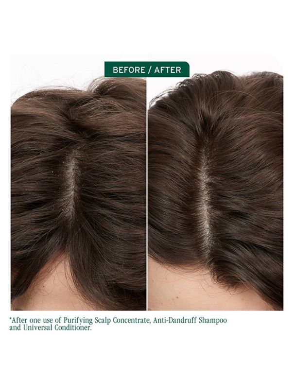 Biolage Scalp Sync Anti-Dandruff Shampoo - 400ml