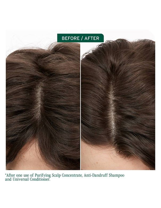 Biolage Scalp Sync Anti-Dandruff Shampoo - 400ml