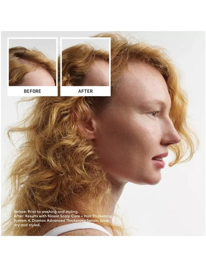 Nioxin System 4 Scalp & Hair Shampoo - 300ml