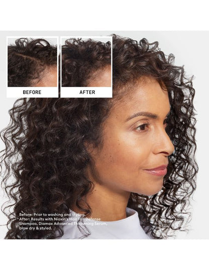 Nioxin Hair Fall Defense Shampoo - 1L