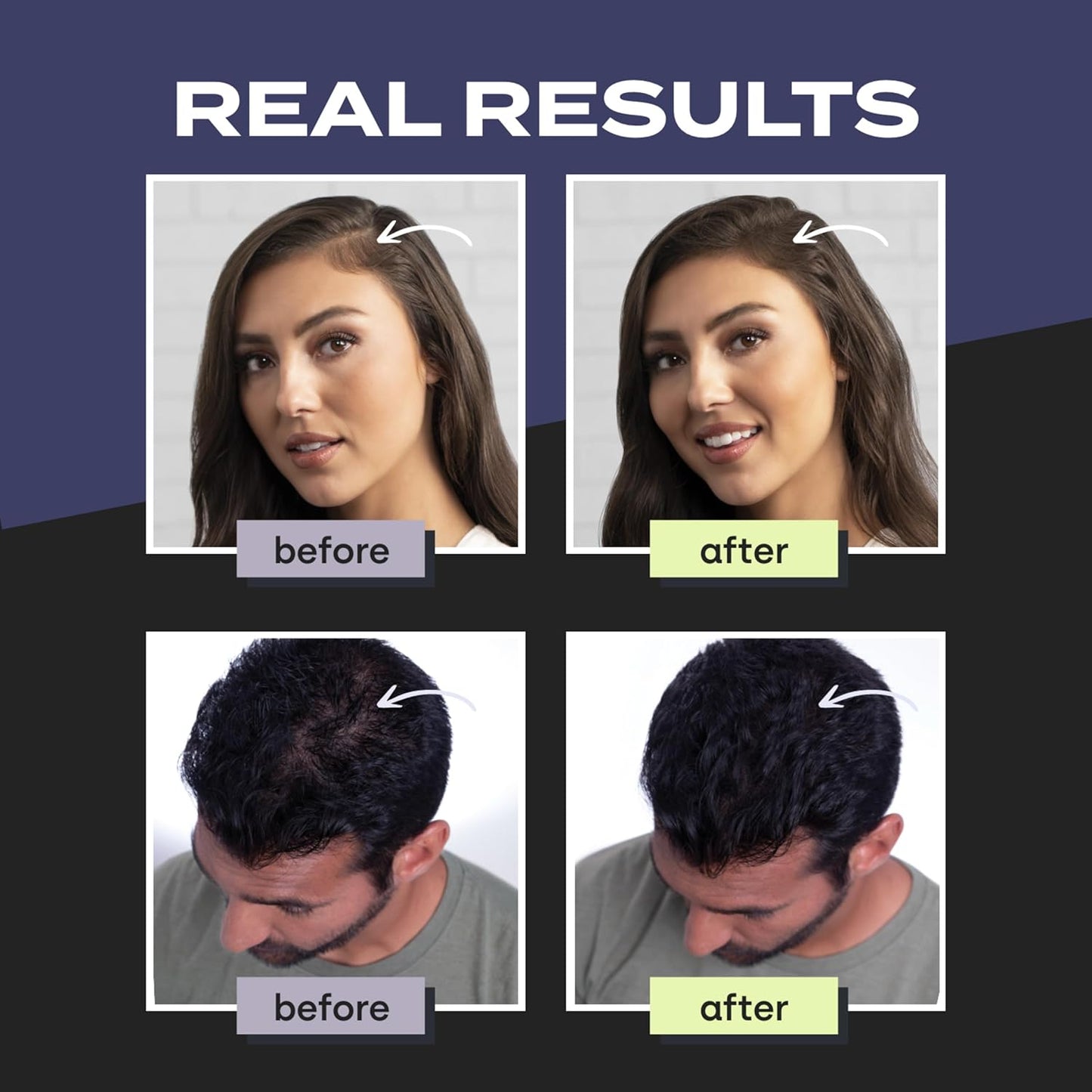 TOPPIK Hair Building Fibers (Black) - 27.5g